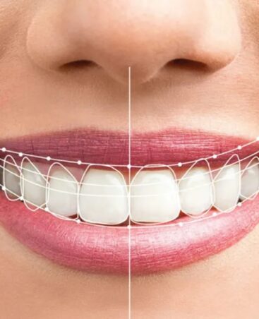 smile-makeover bullsbrook